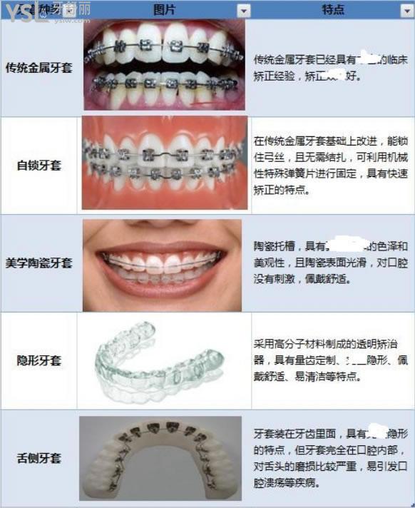 廣州增城做牙齒矯正大概費(fèi)用是多少