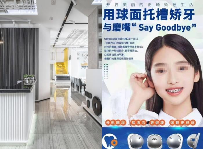 蘭州哪里矯正牙齒比較好