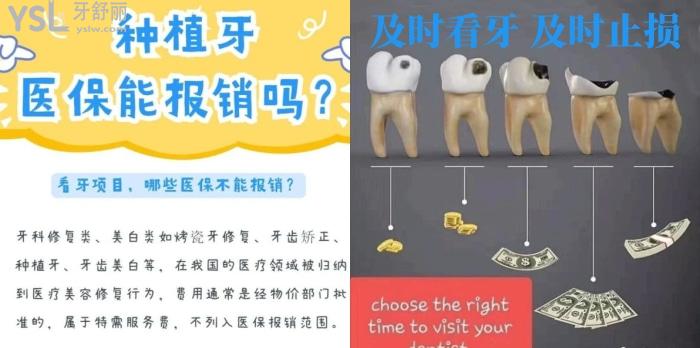 西安口碑好的口腔醫(yī)院推薦團(tuán)圓口腔，二級(jí)口腔醫(yī)院正規(guī)靠譜技術(shù)不俗！
