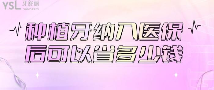 種植牙納入社保后可以省多少錢