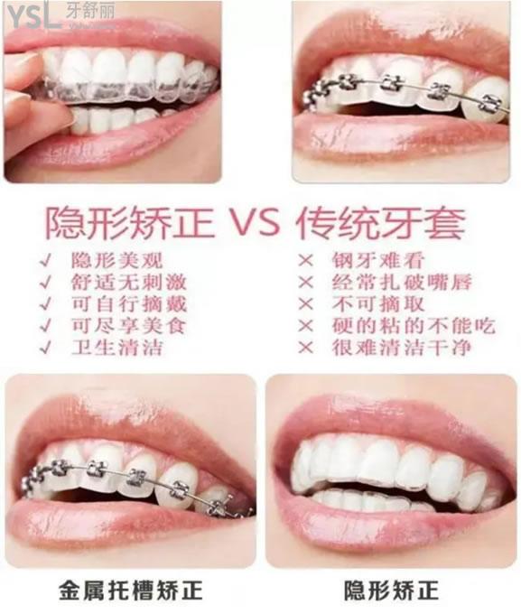 牙齒矯正