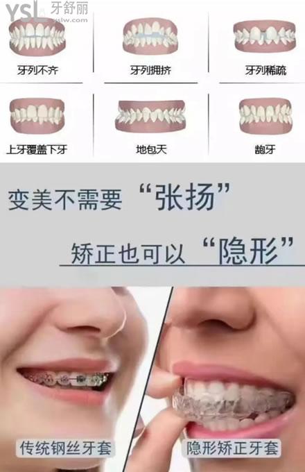 牙齒矯正