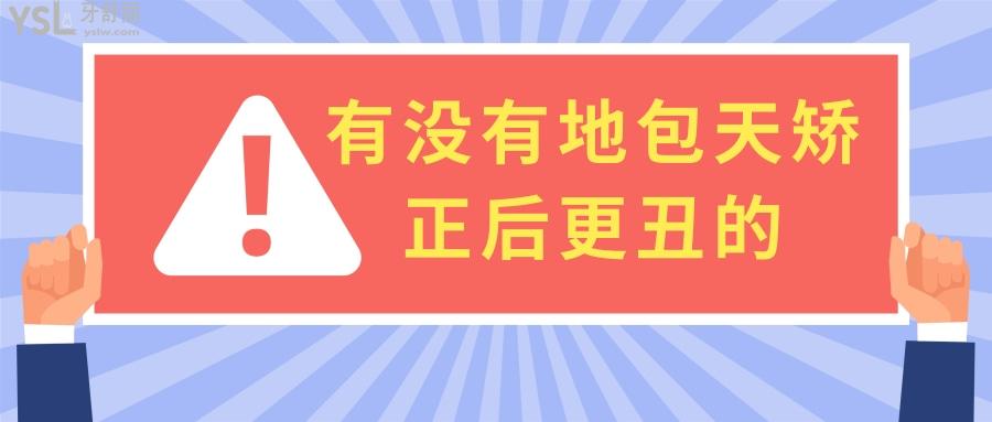 聊聊有沒(méi)有地包天矯正后更丑的，不看后悔錢(qián)白花了