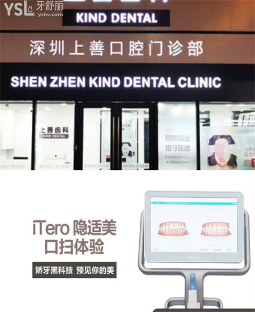 深圳上善齒科收費標(biāo)準(zhǔn)價格表