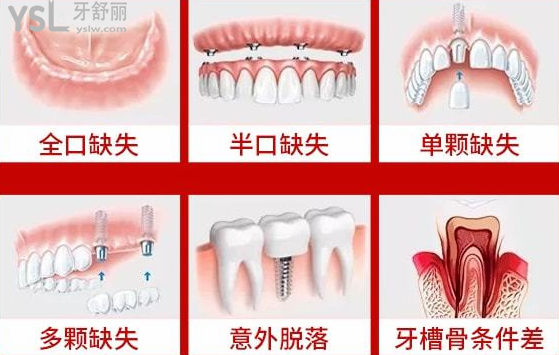 請把這條大數(shù)據(jù)推給缺牙的人，福州維樂口腔醫(yī)院幫助缺牙人士重拾口福！