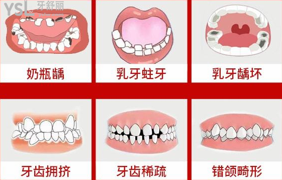 請把這條大數(shù)據(jù)推給缺牙的人，福州維樂口腔醫(yī)院幫助缺牙人士重拾口福！