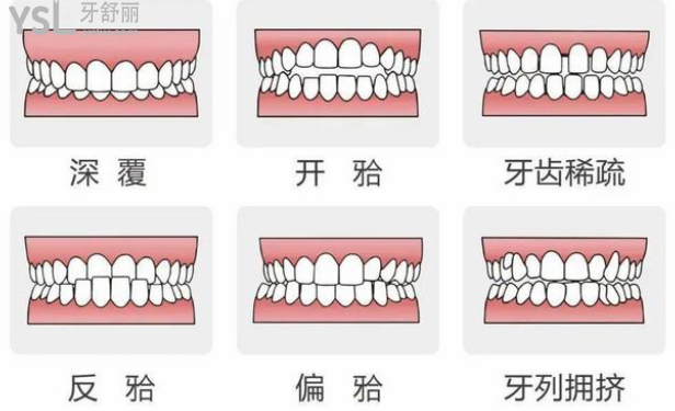 今年比較火的種植牙**，鄭州植得口腔醫(yī)院響應(yīng)號召了！吹爆了！