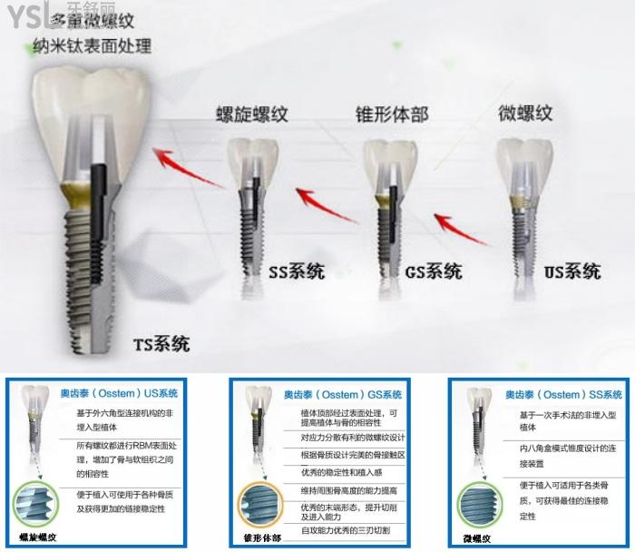 韓國奧齒泰植體的工藝