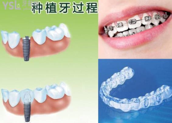 諸暨京韓口腔醫(yī)院可靠嗎