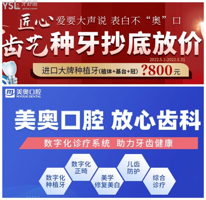 美奧口腔種植牙優(yōu)惠活動
