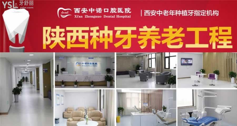 西安中諾口腔醫(yī)院種牙貴不貴
