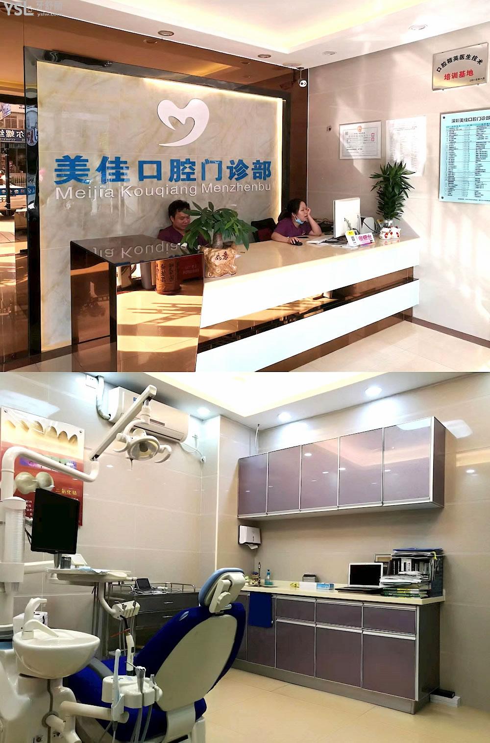深圳美佳口腔門診部怎么樣制定收費(fèi)標(biāo)準(zhǔn)的,牙齒矯正/種植牙價(jià)目表公示好還劃算!