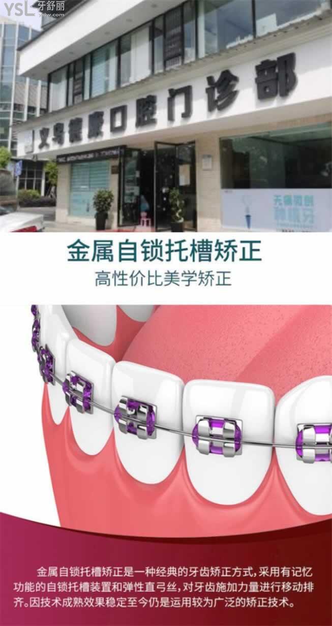 義烏正畸需要多少錢
