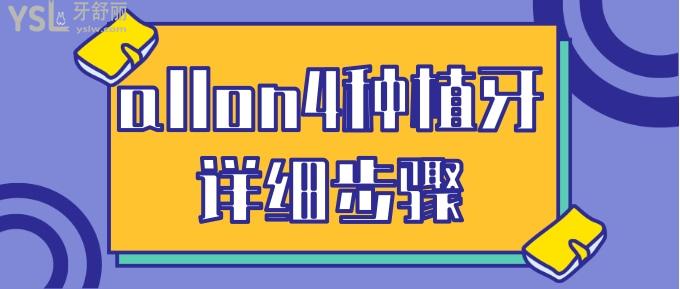 allon4種植牙詳細(xì)步驟