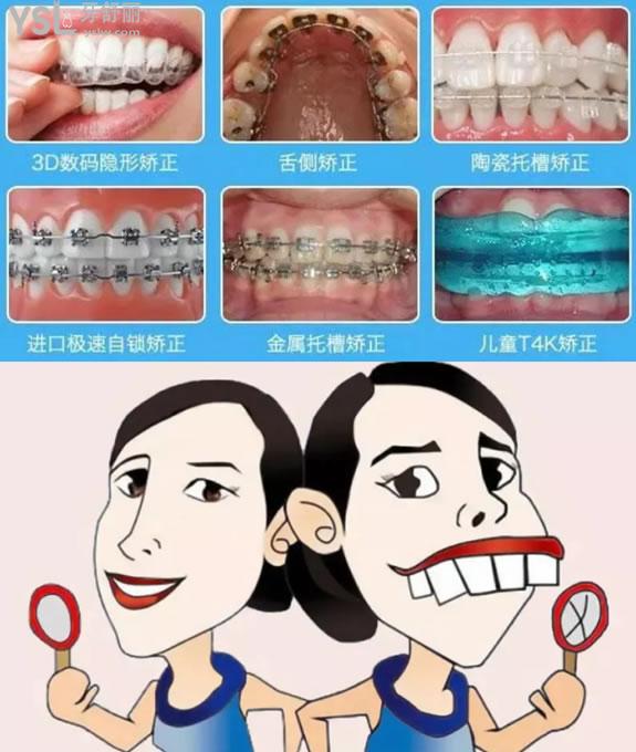 牙齒矯正圖
