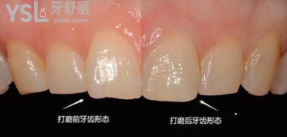 韓國有名的牙科醫(yī)院是哪家，韓國三小時(shí)牙科醫(yī)院
