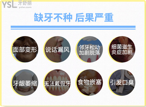 缺牙不補(bǔ)的話引發(fā)后果