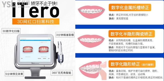 合肥華美口腔牙齒矯正優(yōu)勢