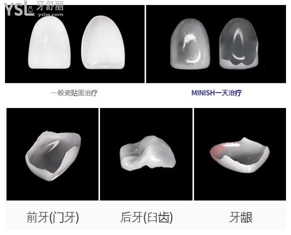 韓國今日安minish牙科