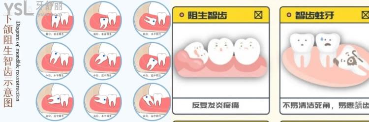 濟(jì)南哪里牙科便宜又好