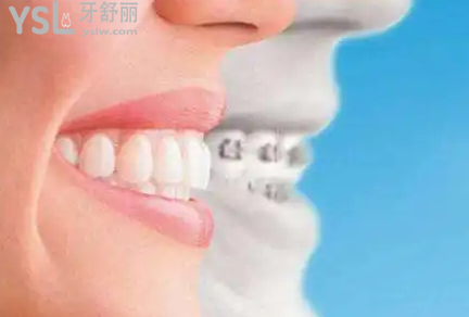 福建晉江金榜口腔醫(yī)院進(jìn)口隱形矯正立減10000元！