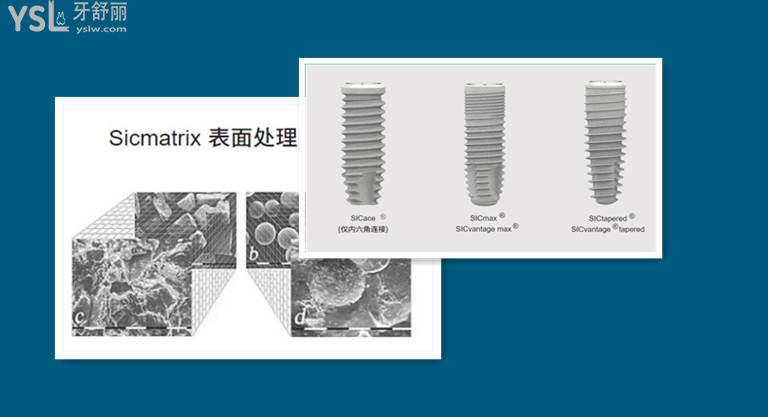 韓國(guó)登騰和奧齒泰種植牙品牌區(qū)別