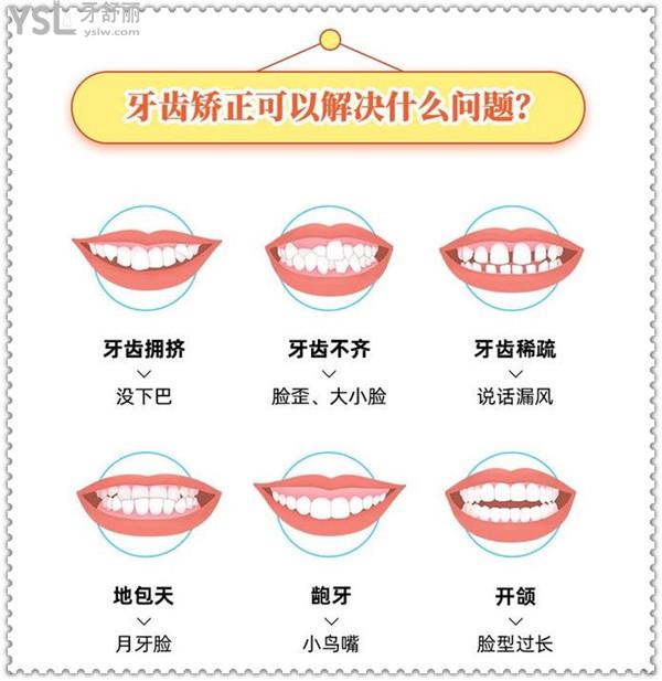 牙齒矯正