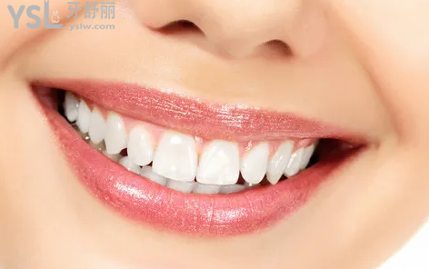 我在拜瑞口腔醫(yī)院做的時(shí)代天使矯正被夸了！