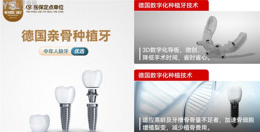 柏德口腔種植牙價格表2022