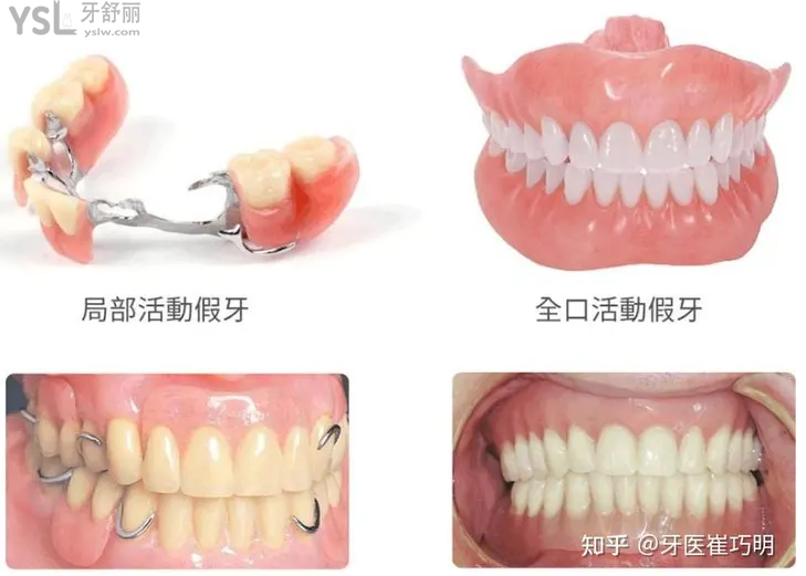 活動假牙