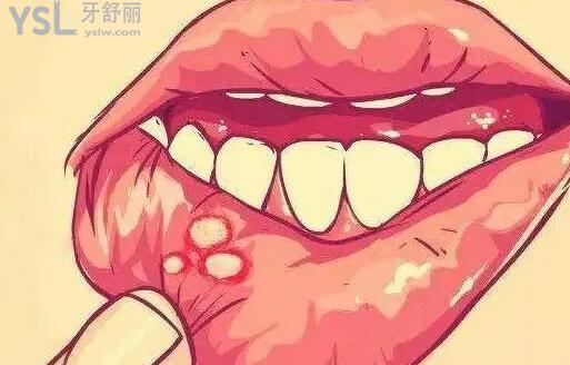 戴牙套后吃飯?zhí)墼趺崔k？這幾種牙疼方式你是否也中招了？.jpg