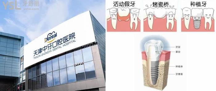天津中諾口腔醫(yī)院和天津中牙口腔醫(yī)院比哪個(gè)好一些