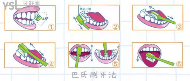 Bass刷牙法