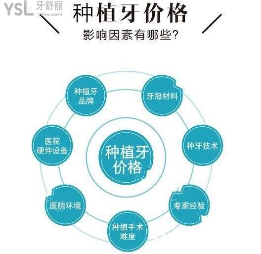 種植牙價(jià)格因素