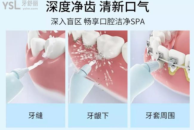 沖牙器可以清潔地方