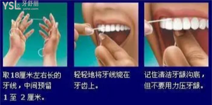如何使用牙線