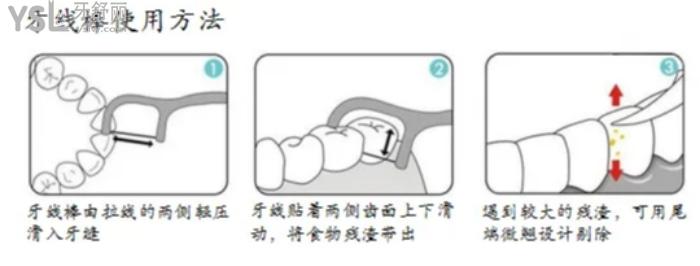 如何使用牙線棒