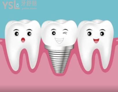 長(zhǎng)沙口腔醫(yī)院價(jià)格表及口碑較好的牙科醫(yī)院排行榜