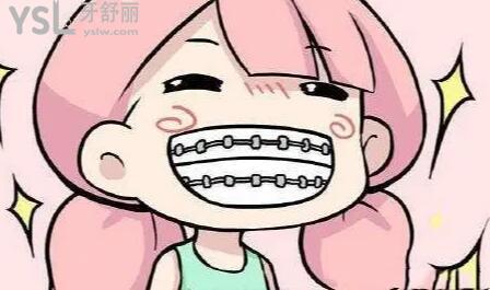 戴上牙套后多久可以正常吃東西及如何正確的護理牙齒！.jpg