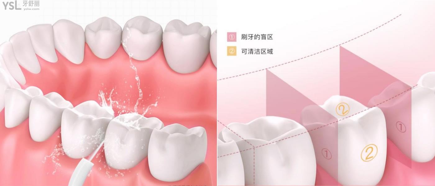 沖牙器