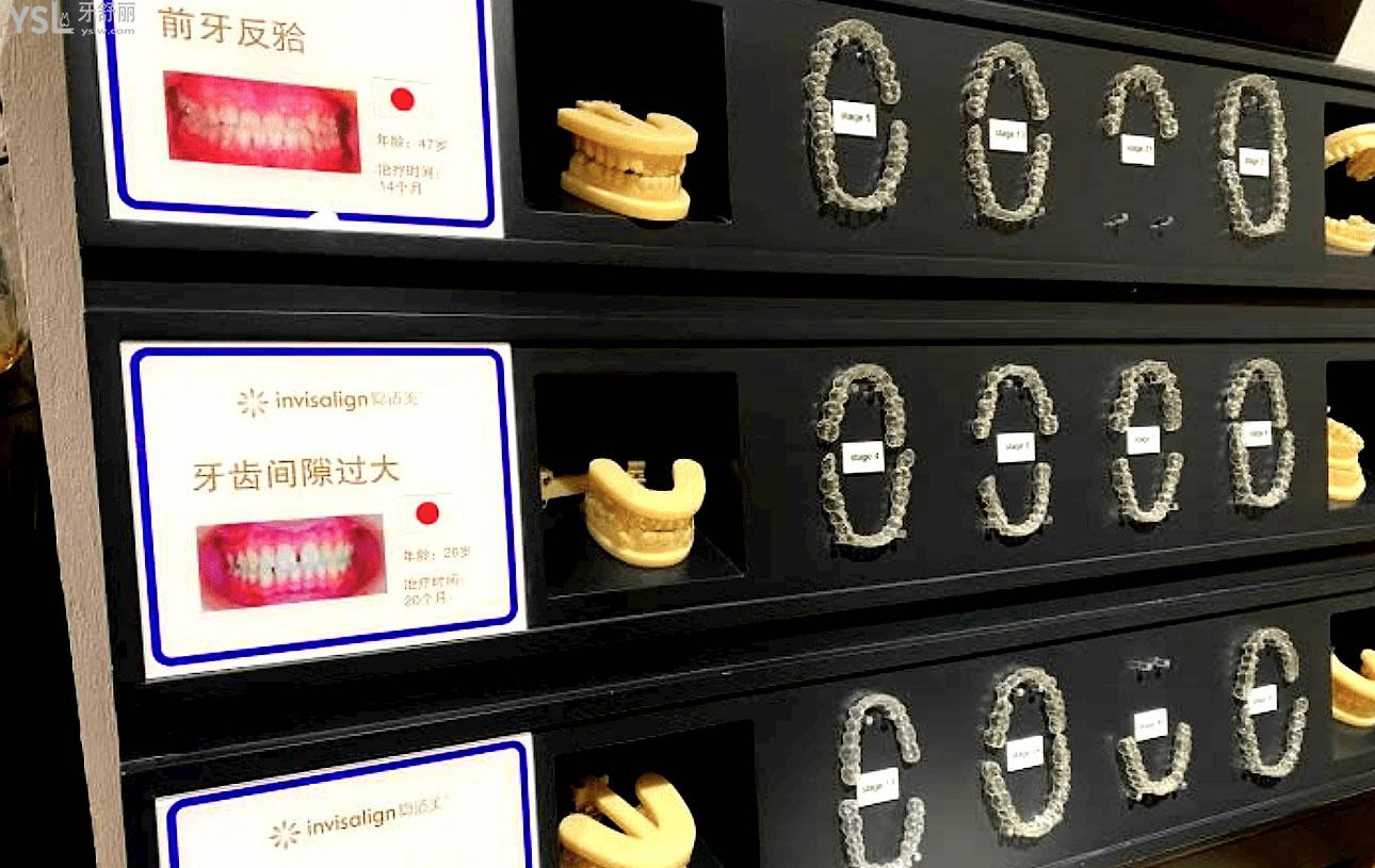 上海薇琳口腔醫(yī)院正規(guī)靠譜嗎
