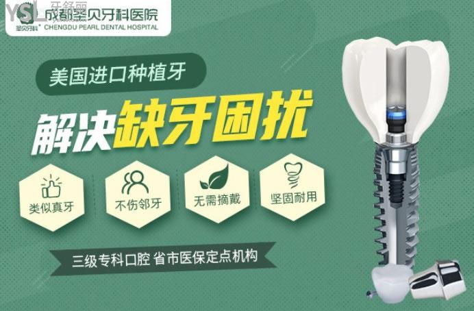 成都圣貝口腔種植優(yōu)勢