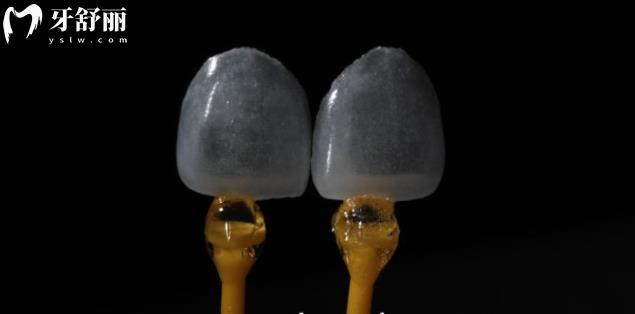 超薄牙貼面做完還能啃排骨嗎？吃貨們可要注意了