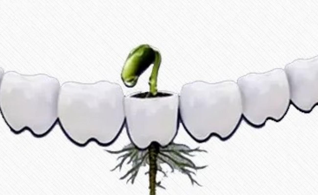 百康種植牙是哪個(gè)國(guó)的品牌
