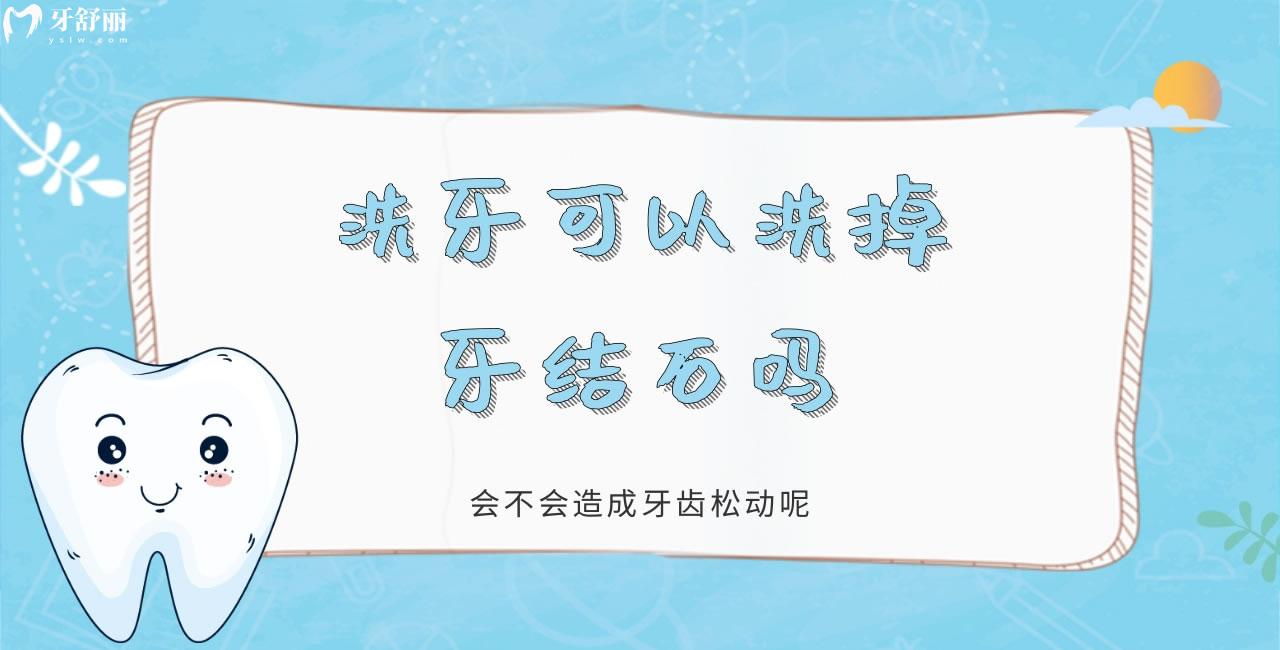 洗牙可以洗掉牙結(jié)石嗎 會(huì)不會(huì)造成牙齒松動(dòng)呢
