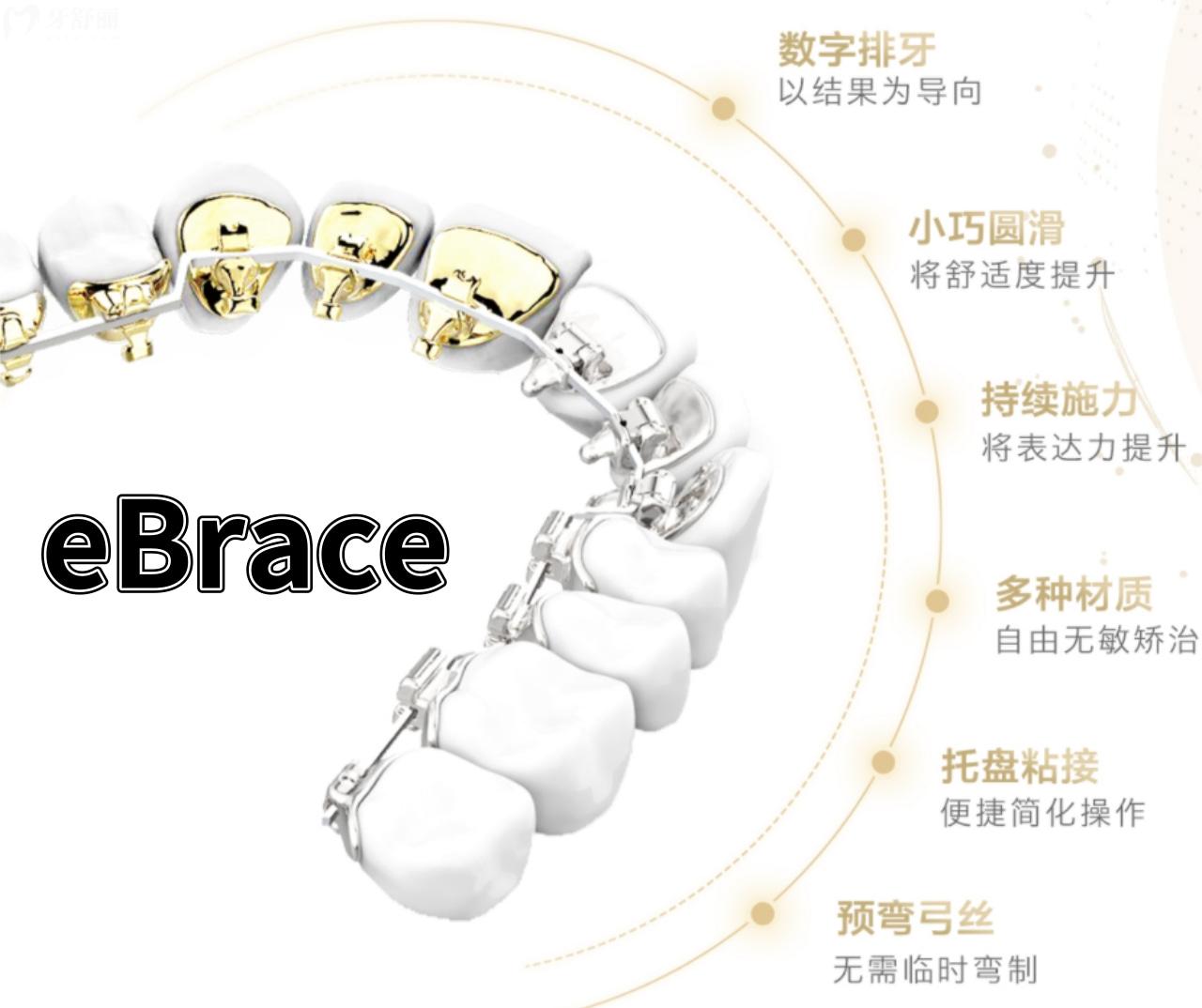 eBrace易美正畸自鎖矯正