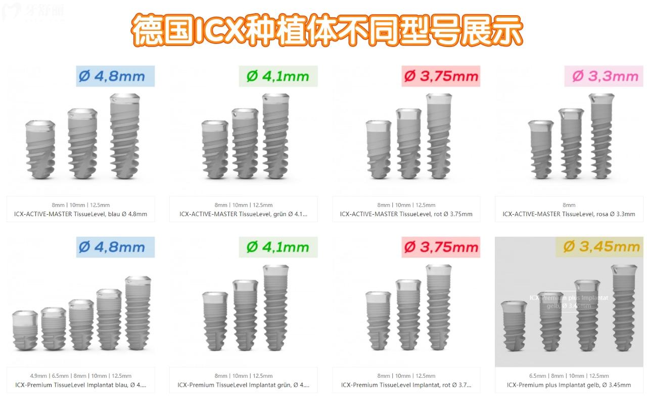 德國ICX種植體有哪些型號