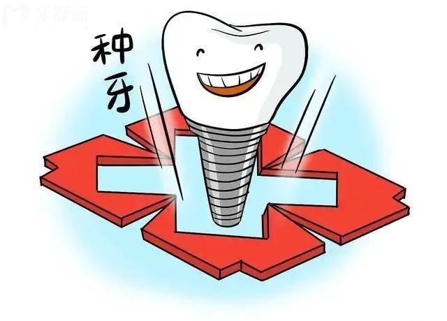 瑞士士卓曼種植牙使用壽命是多少年