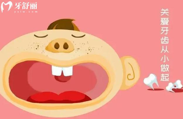 關(guān)愛寶寶牙齒卡通圖