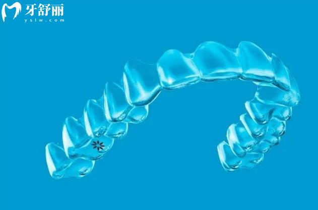 隱適美隱形矯正